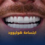 ابتسامة هوليوود