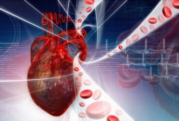 طب القلب والشرايين